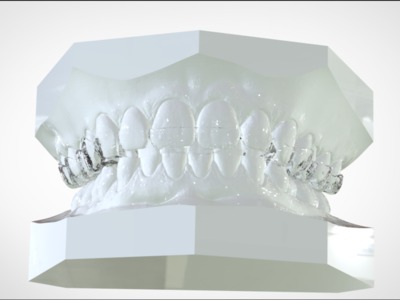 牙齿模型1